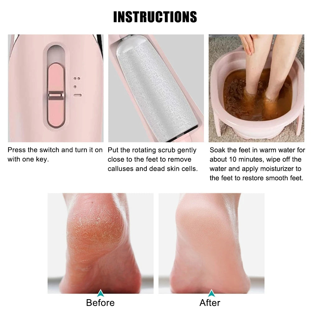 Electric Foot Callus Remover