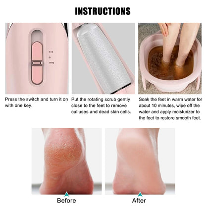 Electric Foot Callus Remover